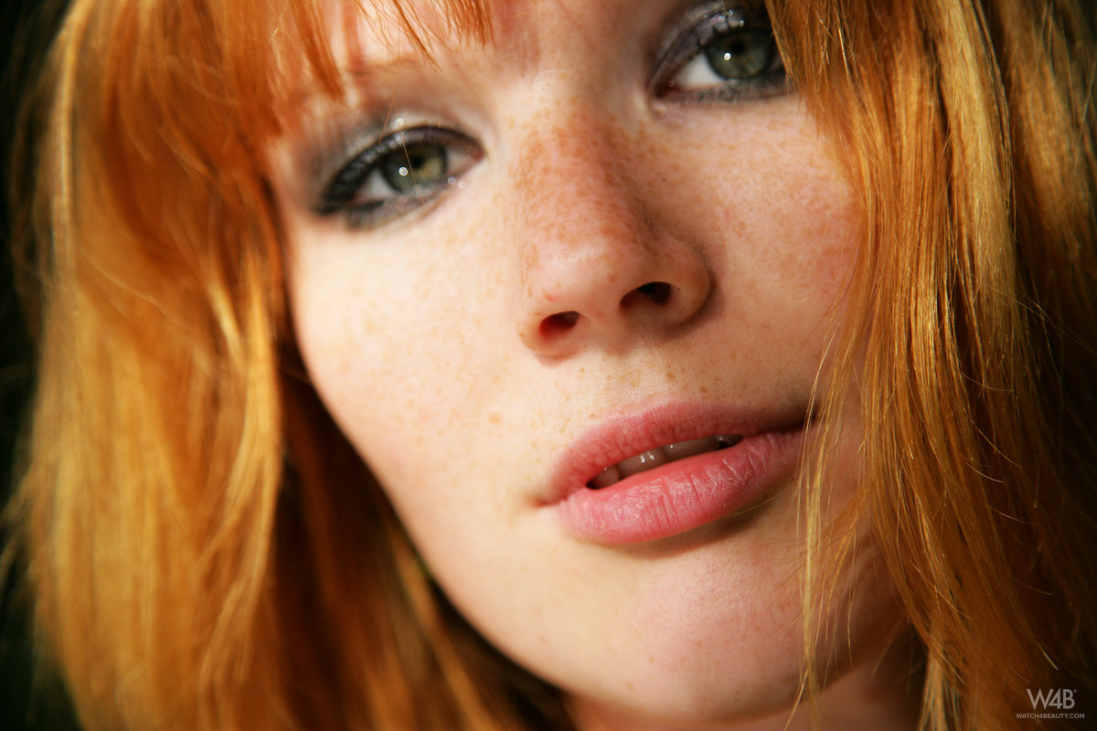 Lynette: Freckled