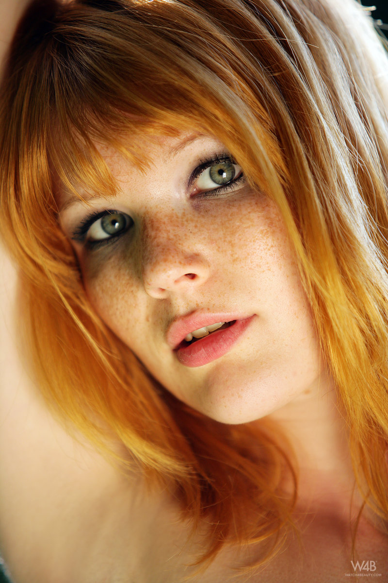 Lynette: Freckled